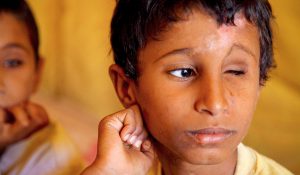 Mohammed Ali as Saadi, 9 år, förlorade ena ögat i en minolycka.